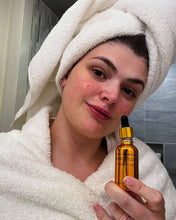 Load image into Gallery viewer, EpiLynx - Brightening Vitamin C Serum - Skin Damage Repair
